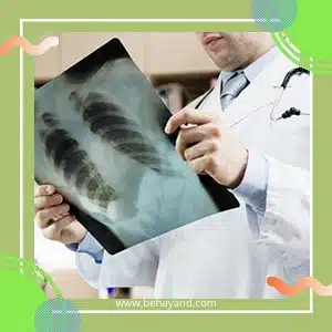 بهترین مرکز درمان سرطان در تهران